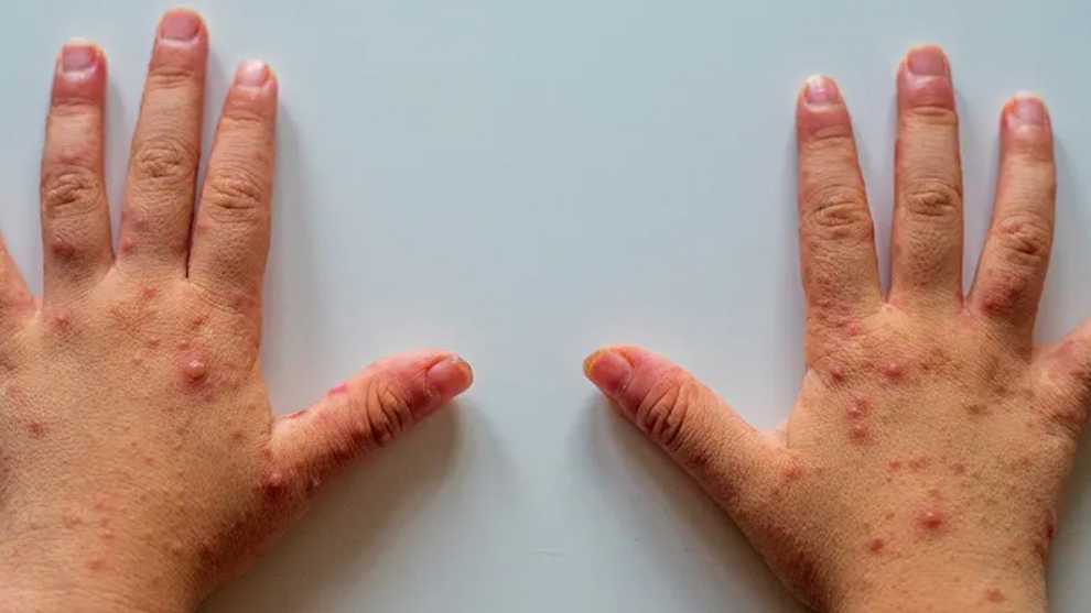 Prof. Dr. Doğancı: “Hasta çocuklar bir hafta evde izole edilmeli”