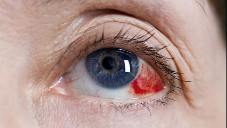 Uzmanlar uyarıyor: Gözlerinizi kaybetmeden önlem alın